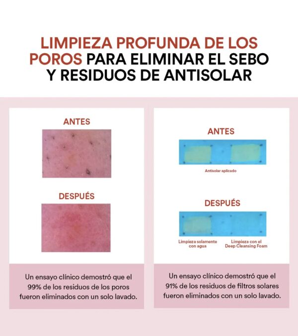 Skin1004 - Madagascar Centella Poremizing Deep Cleansing Foam - Imagen 3