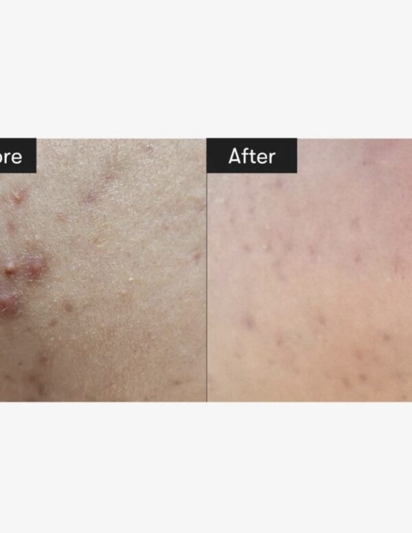 VT Cosmetics - Mild Reddle Shot - Imagen 3