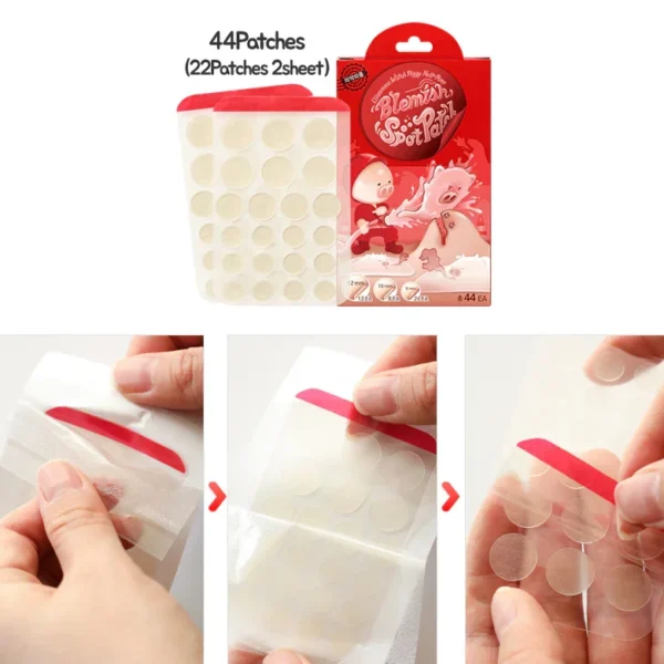 ELIZAVECCA - Witch Piggy Hell Pore Blemish Spot Patch - 44 parches - Imagen 3