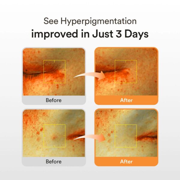 Abib - Glutathiosome Dark Spot Serum Vita Drop (Desvanece Manchas e Ilumina) - Imagen 3